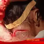 Balita Tiga Tahun di Gresik Alami Luka Parah Akibat Serangan Monyet Liar