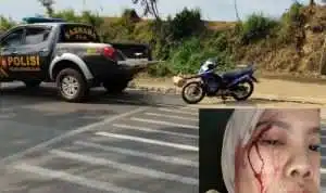 Anggota TNI AL Diduga Lepas Tangan Usai Sebabkan Laka di Pasuruan