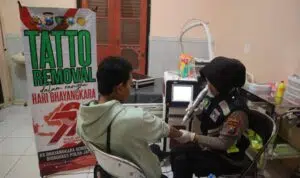Polres Situbondo Beri Layanan Hapus Tato Gratis di Hari Bhayangkara ke -79