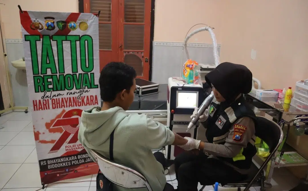Polres Situbondo Beri Layanan Hapus Tato Gratis di Hari Bhayangkara ke -79
