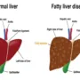 15 Makanan Alami untuk Detoks Liver