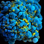 450px-HIV_H9_T-cell.jpg 450px HIV H9 T cell
