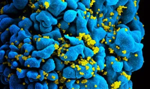 450px HIV H9 T cell