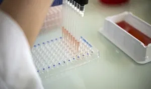 Ahli Imunologi Unair , Mikrobiologi, Super Flu,