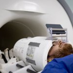 ai enhanced mri could better detect brain abnormalities