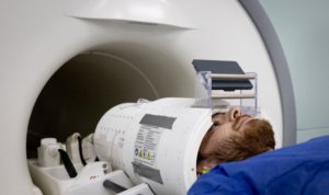 ai enhanced mri could better detect brain abnormalities